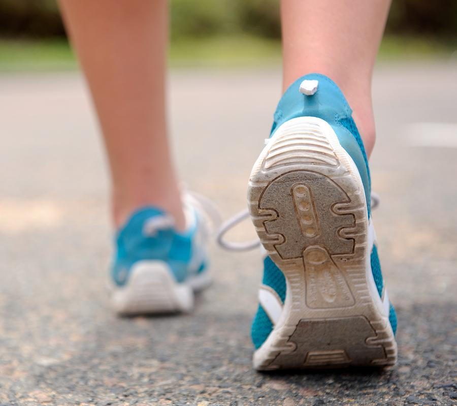How to Get Rid of Bunions