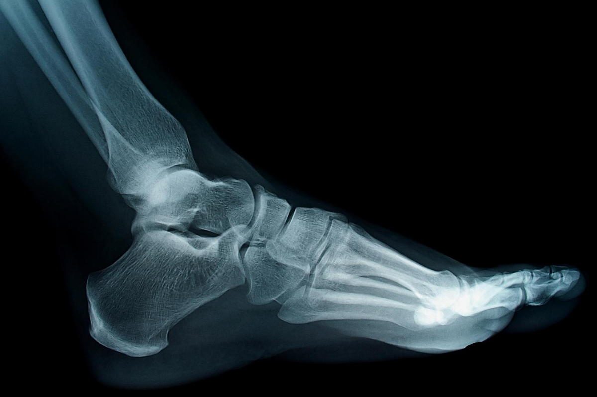 Nerve Pain Treatment