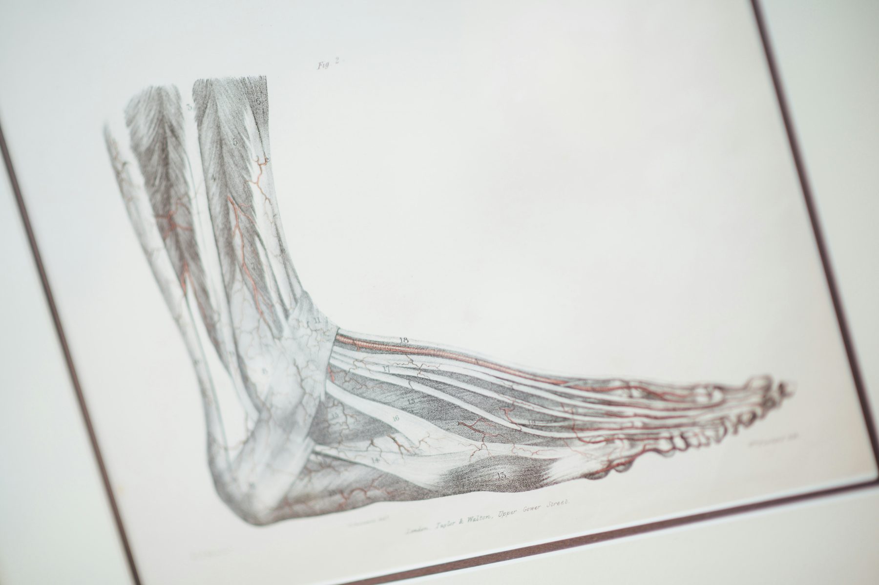 Foot image showing nerves, tendons, and bone