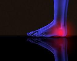 Treatment Options for Heel Pain
