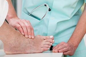 What To Do If You Have Bunions?