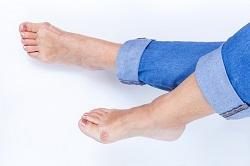 What to Do When You Have a Bunion