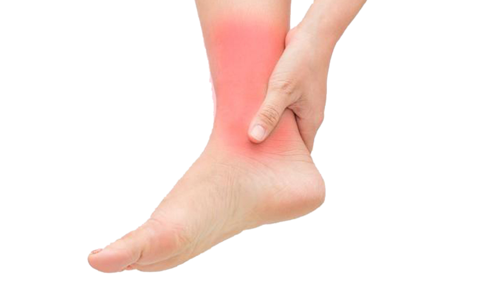 Ankle Sprains