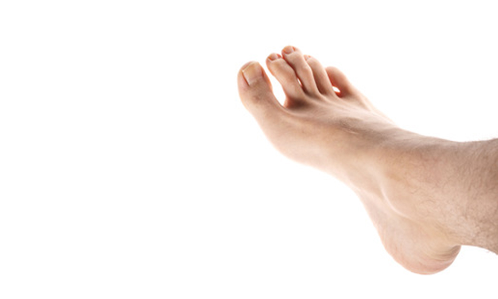 Hammertoes