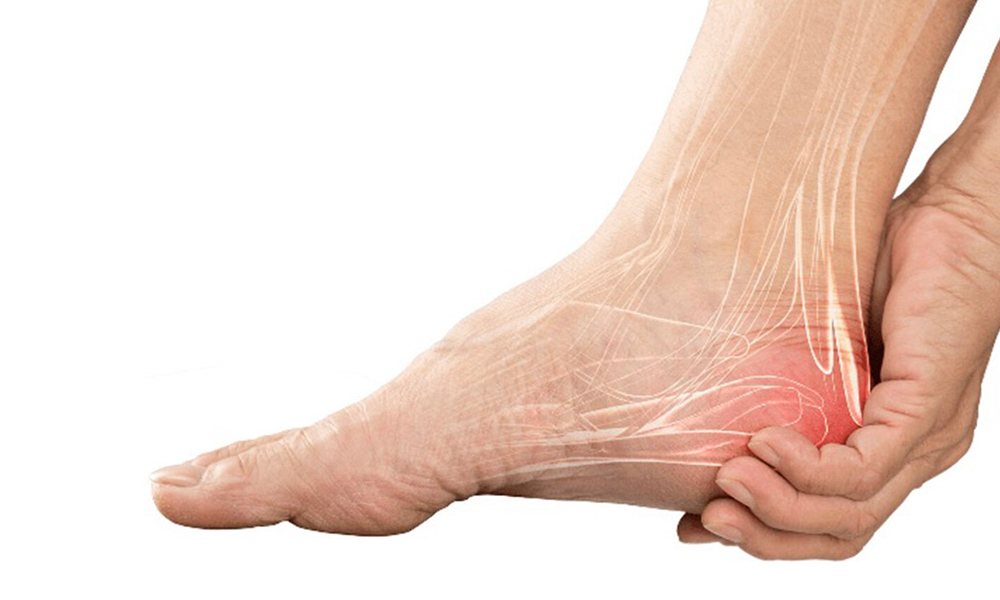 Heel Pain
