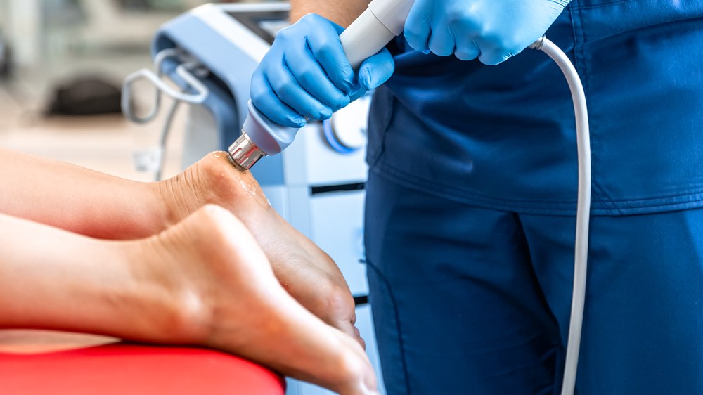 Shockwave Therapy — clinical illustration