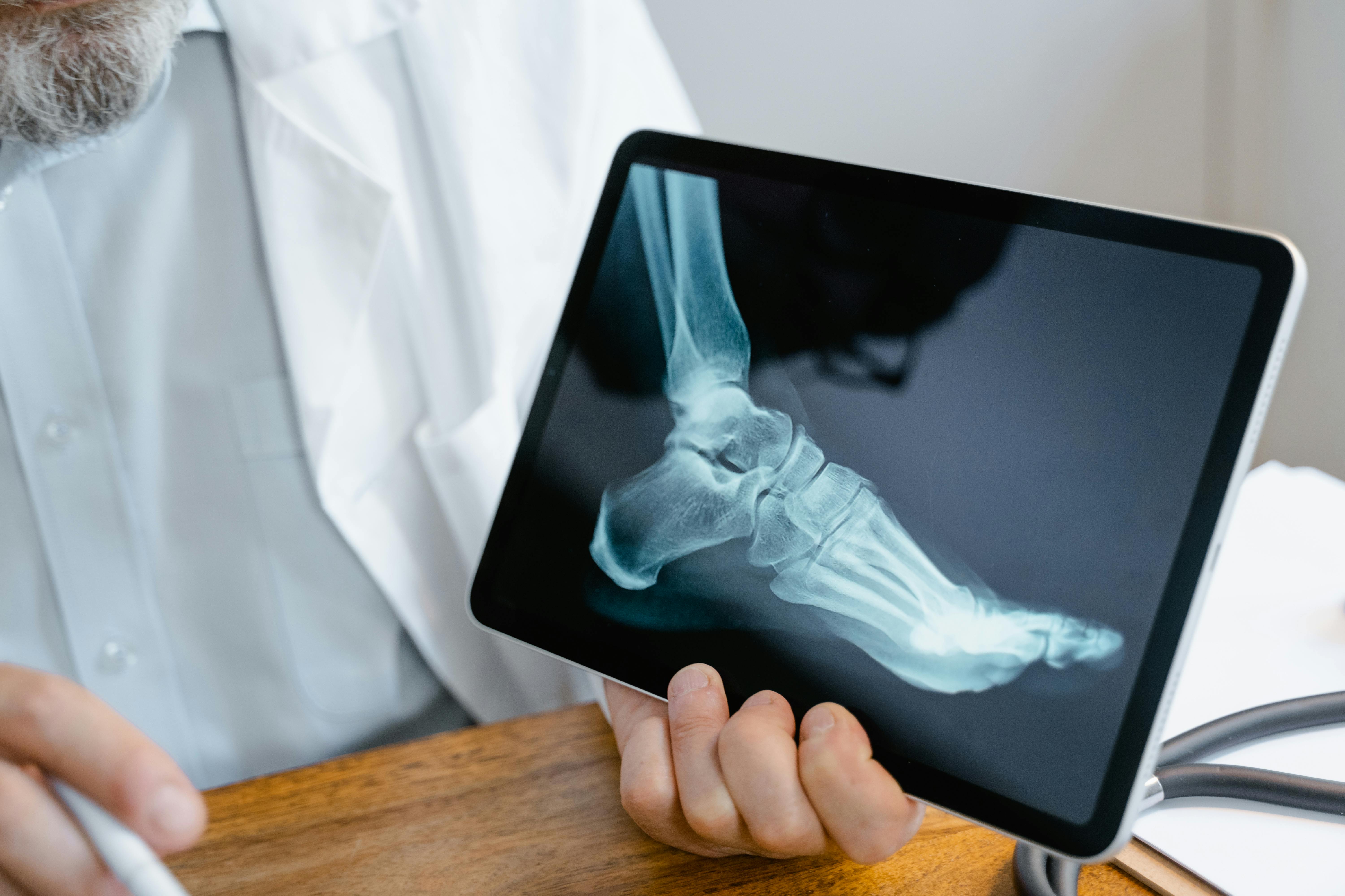 Ankle Replacement